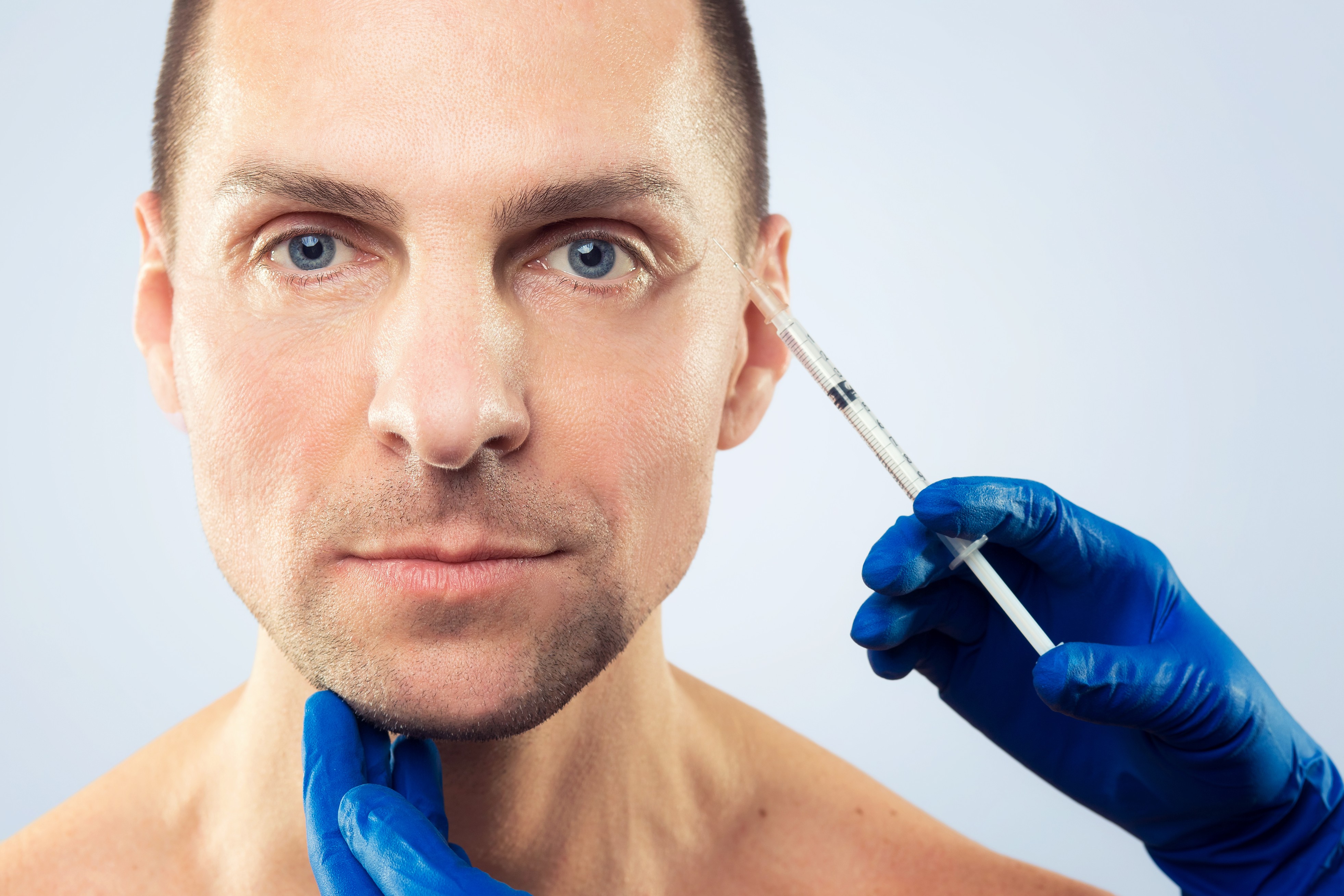 What makes FUE Hair Transplant Procedure the most Successful Technique?