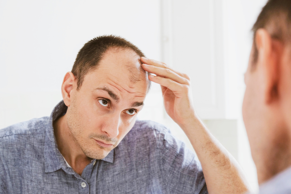 Causes Hair Loss