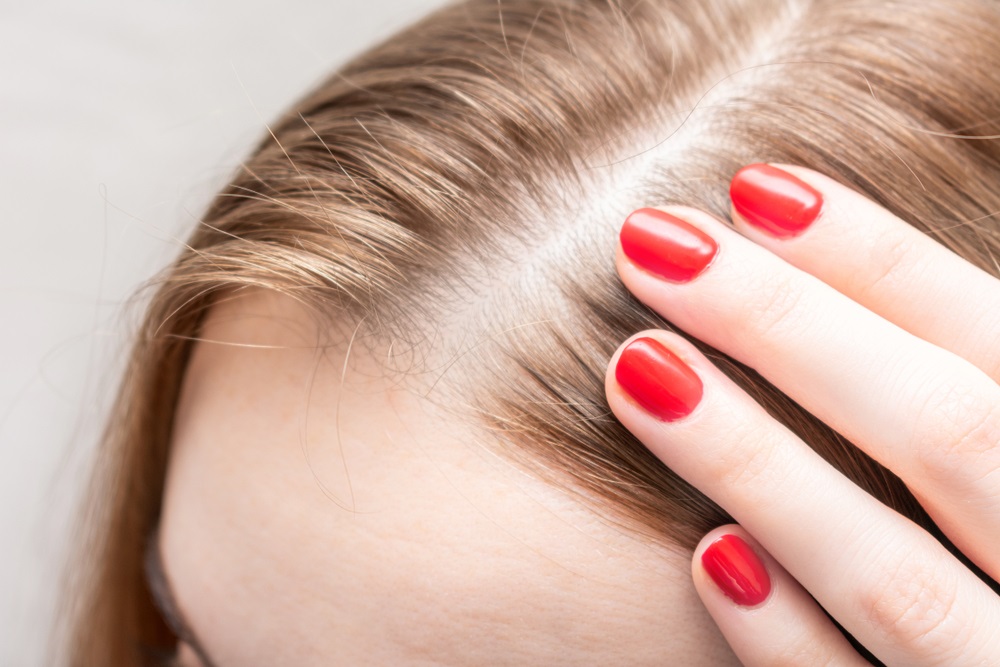 Hair Loss Treatment