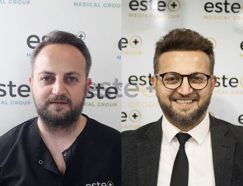 before and after hair treatment