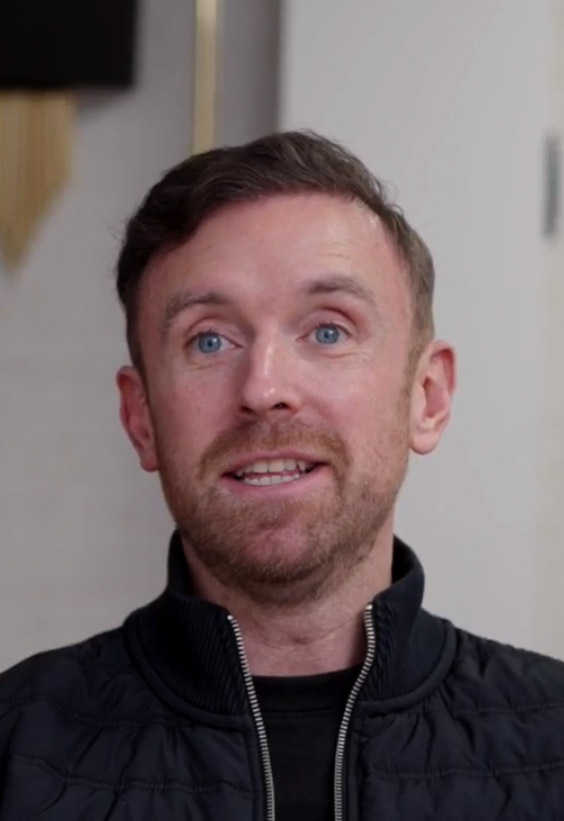 Steve Cavanagh before after Hair transplant