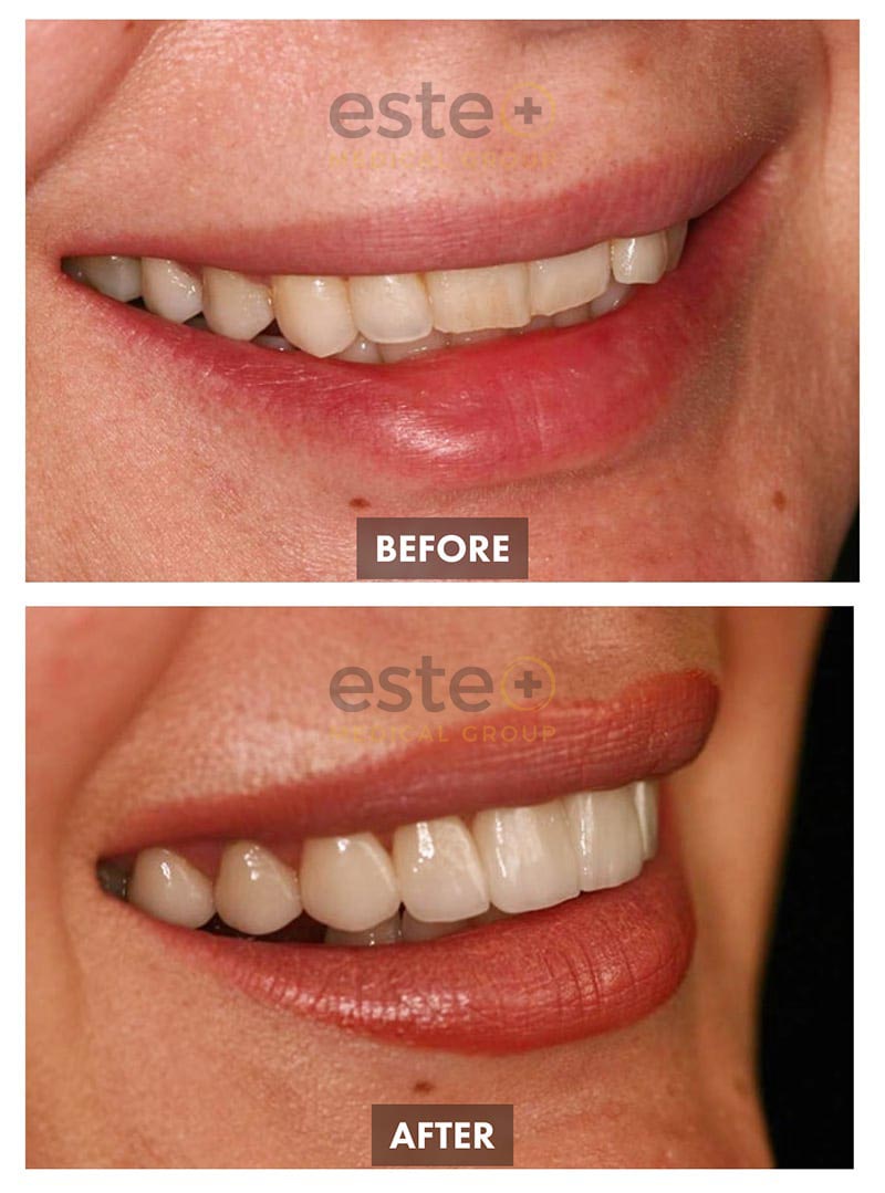 Cosmetic Dentistry Results