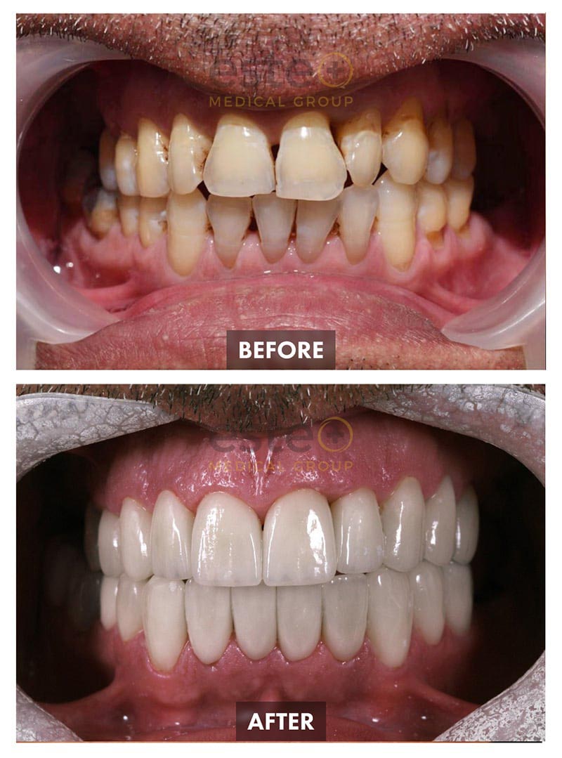 Dentistry Before-after Images - Este