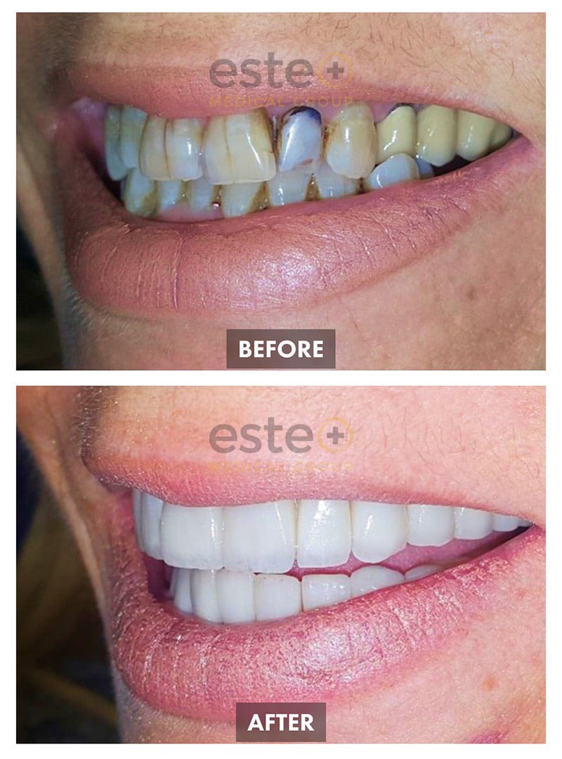 Cosmetic Dentistry Results