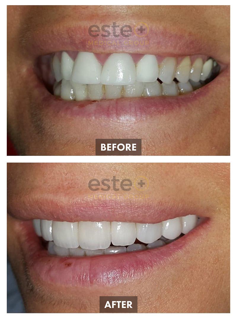 Cosmetic Dentistry Results