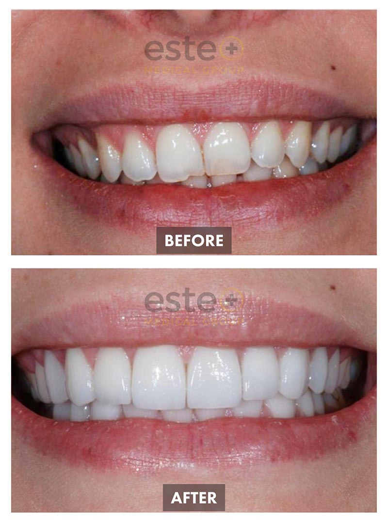 Cosmetic Dentistry Results