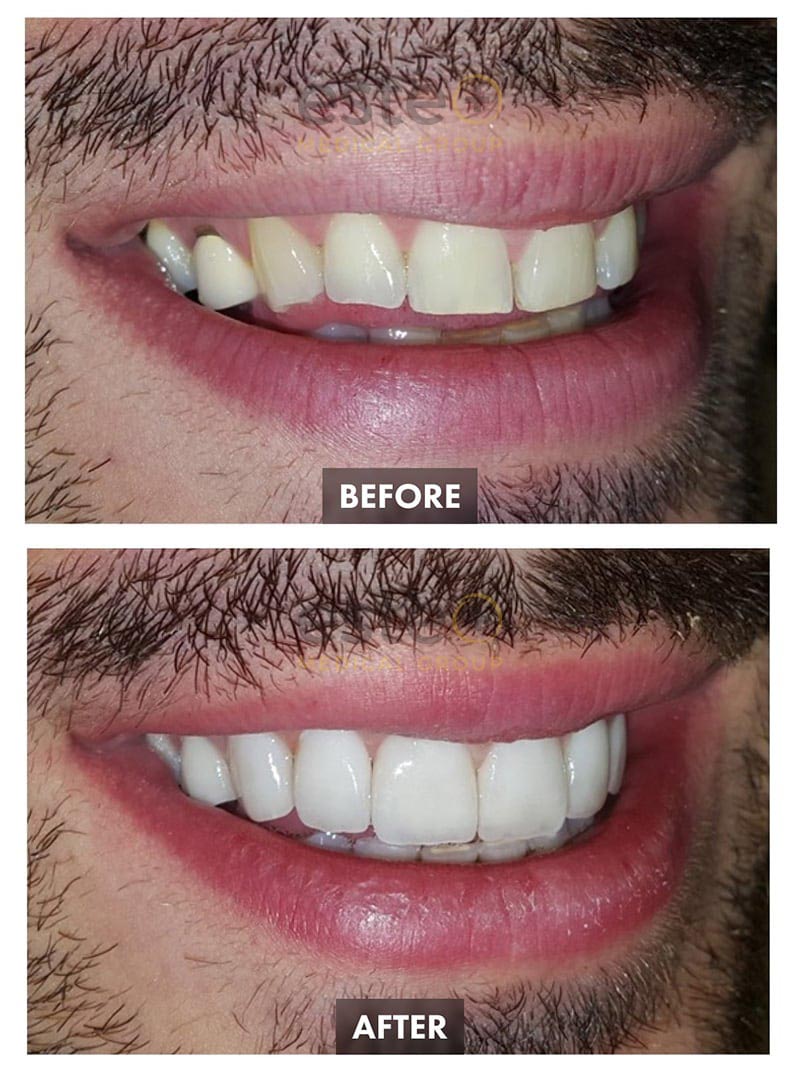 Cosmetic Dentistry Results