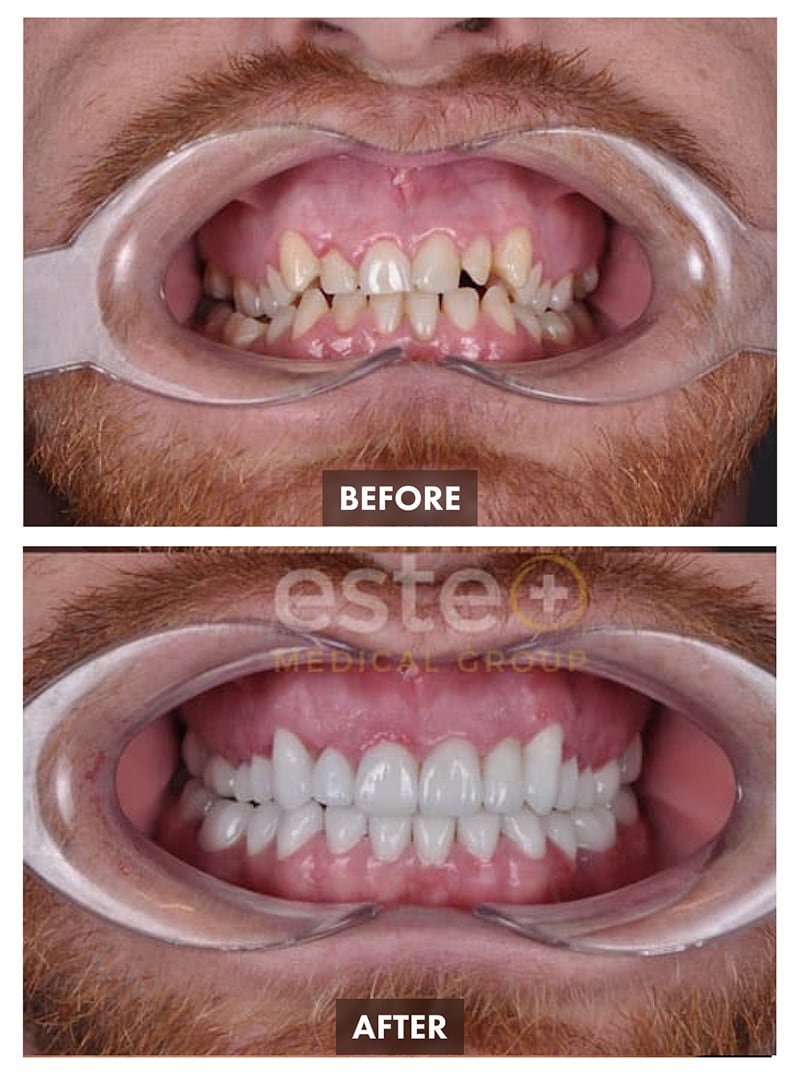 Dentistry Before-after Images - Este