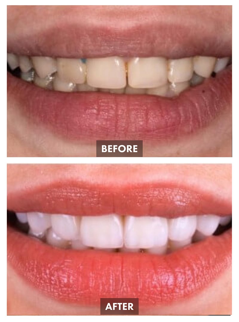 Dentistry Before-after Images - Este