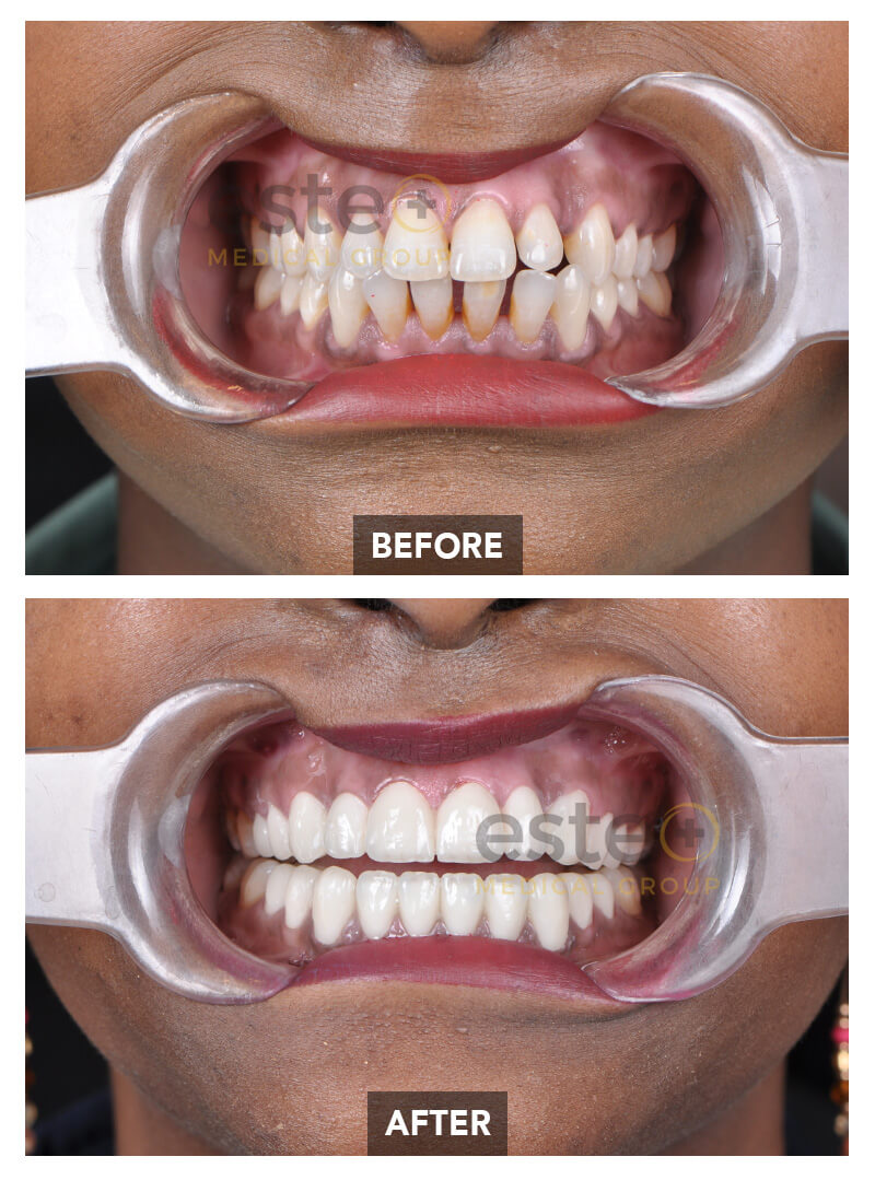 Nima - Dentistry Before after images