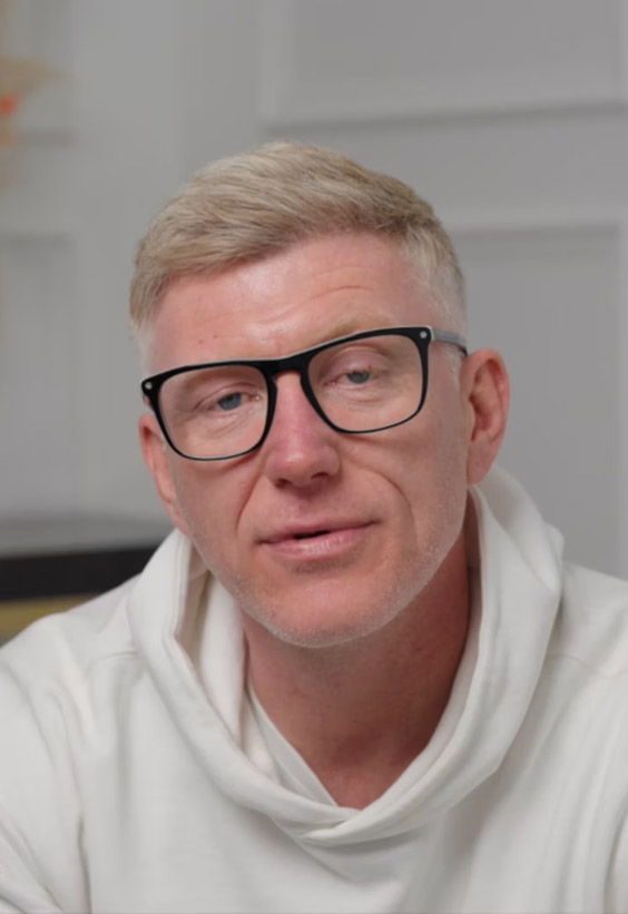 Wayne Brown Hair transplant before after images - Este