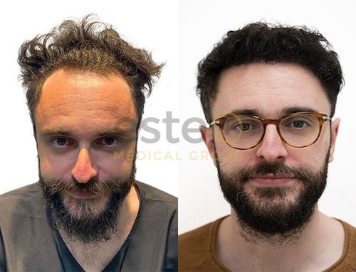 Hair treatment results
