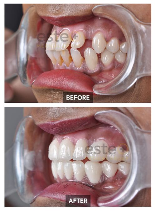 Dentistry Before-after Images - Este