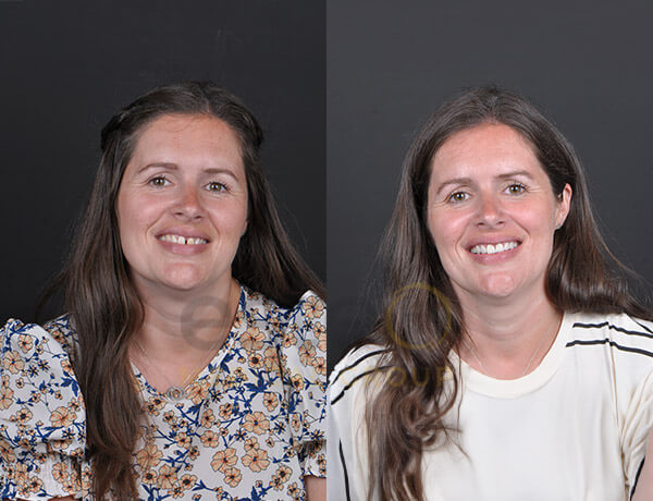 Kristy before after results 
