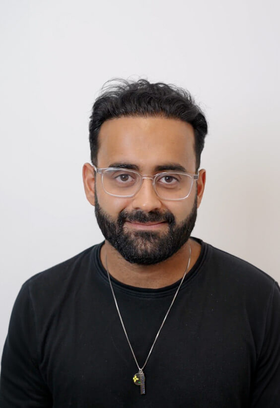 Rish's Hair Transplant results with Este Medical