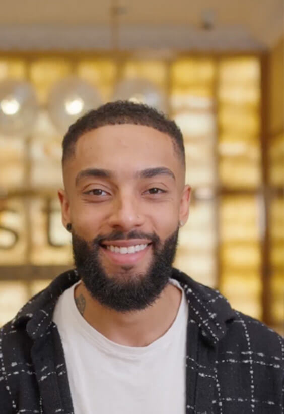 Jessie Taylor - Hair transplant Journey with Este Medical
