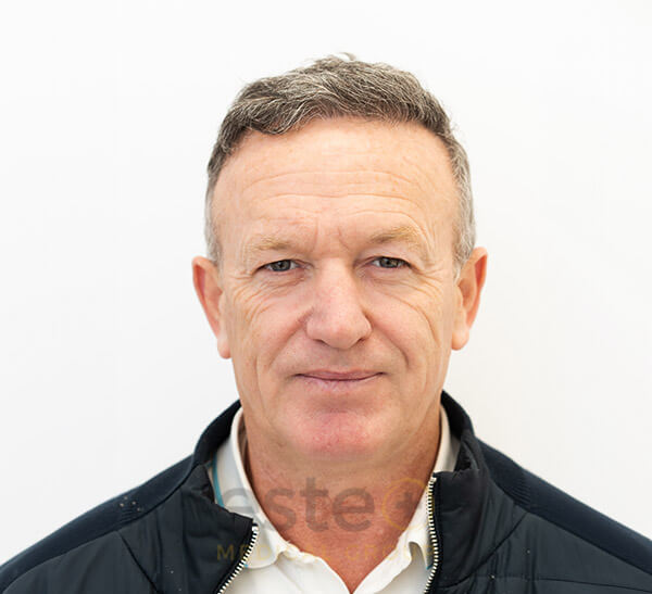 Hair Transplant Male