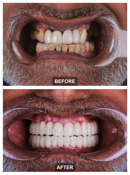 Kully's dental treatment with Este Medical