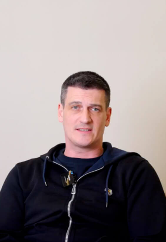Hair Transplant Male