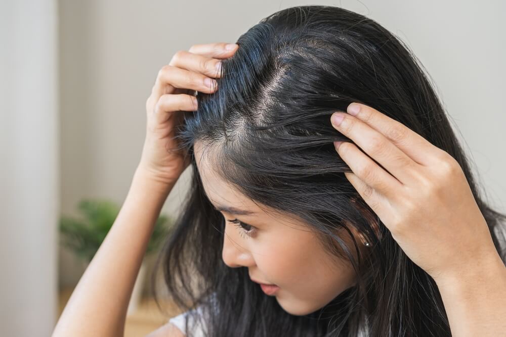 Before and after hair restoration results at Este Medical Clinic