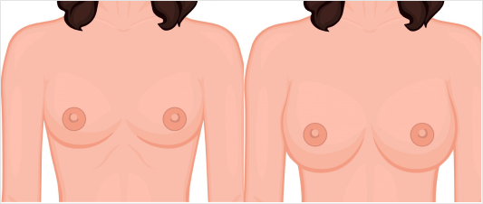 What makes FUE Hair Transplant Procedure the most Successful Technique?