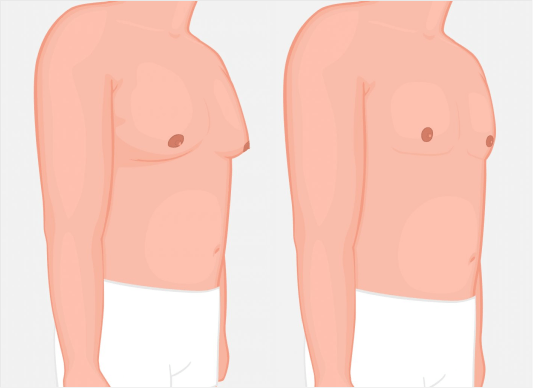 What makes FUE Hair Transplant Procedure the most Successful Technique?