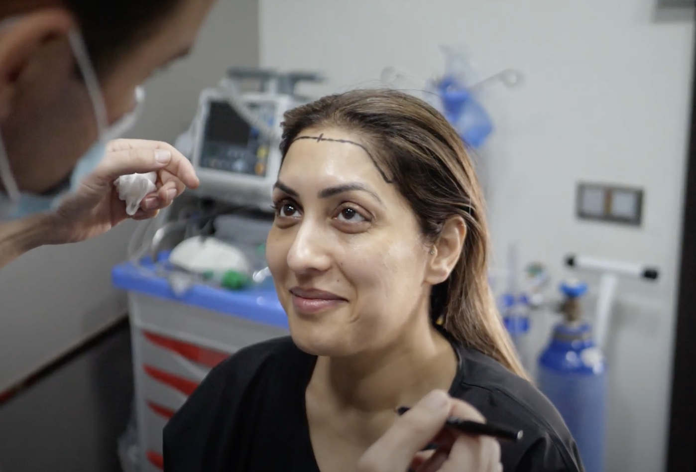 female hair transplant