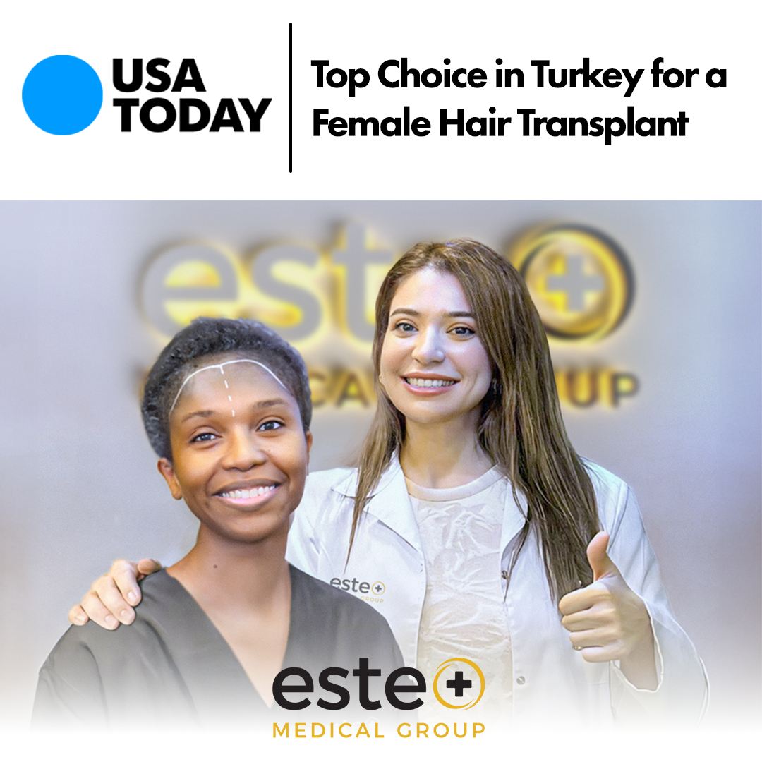 Top choice in Turkey for a female hair transplant