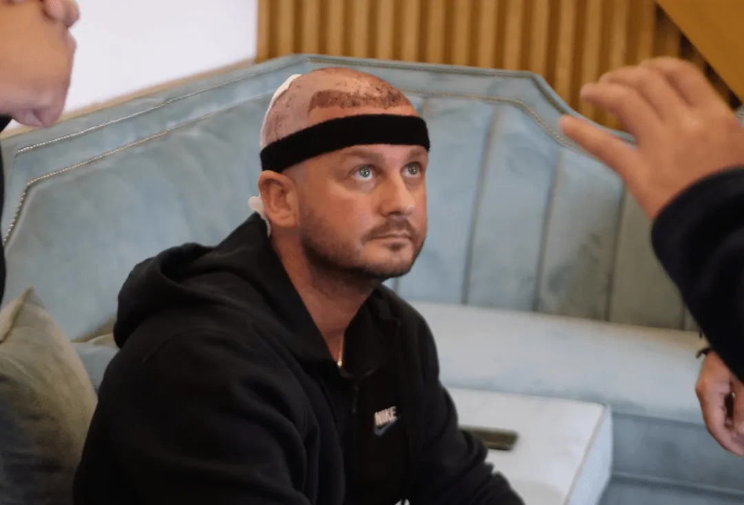 hair transplant treatment